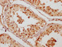 IHC image of CAC15905 diluted at 1:200 and staining in paraffin-embedded human testis tissue performed on a Leica BondTM system. After dewaxing and hydration, antigen retrieval was mediated by high pressure in a citrate buffer (pH 6.0). Section was blocked with 10% normal goat serum 30min at RT. Then primary antibody (1% BSA) was incubated at 4°C overnight. The primary is detected by a Goat anti-rabbit polymer IgG labeled by HRP and visualized using 0.05% DAB.