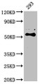 Western Blot, Positive WB detected in: 293 whole cell lysate, All lanes: CYP27B1 antibody at 1:2000, Secondary, Goat polyclonal to rabbit IgG at 1/50000 dilution, Predicted band size: 57 kDa, Observed band size: 57 kDa