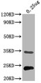 Western Blot, Positive WB detected in Recombinant protein, All lanes:eutC antibody at 1:2000, Secondary, Goat polyclonal to rabbit IgG at 1/50000 dilution, Predicted band size: 32 kDa, Observed band size: 32 kDa