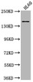 Western Blot, Positive WB detected in: HL60 whole cell lysate, All lanes: SMARCC2 antibody at 1:2000, Secondary, Goat polyclonal to rabbit IgG at 1/50000 dilution, Predicted band size: 133, 125, 127 kDa, Observed band size: 170 kDa