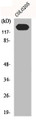 Western Blot analysis of C0L0205 cells using N-cadherin Polyclonal Antibody