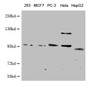 Western Blot, Positive WB detected in: 293 whole cell lysate, MCF-7 whole cell lysate, PC-3 whole cell lysate, Hela whole cell lysate, HepG2 whole cell lysate, All lanes: FILIP1L antibody at 1:1000, Secondary, Goat polyclonal to mouse IgG at 1/50000 dilution, Predicted band size: 29, 80, 102, 130 KDa, Observed band size: 102 KDa, Exposure time：5min
