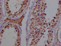 IHC image of CAC15938 diluted at 1:100 and staining in paraffin-embedded human testes tissue performed on a Leica BondTM system. After dewaxing and hydration, antigen retrieval was mediated by high pressure in a citrate buffer (pH 6.0). Section was blocked with 10% normal goat serum 30min at RT. Then primary antibody (1% BSA) was incubated at 4°C overnight. The primary is detected by a biotinylated secondary antibody and visualized using an HRP conjugated SP system.