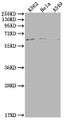 Western Blot, Positive WB detected in: K562 whole cell lysate, Hela whole cell lysate, A549 whole cell lysate, All lanes: MAP3K7 antibody at 1:500, Secondary, Goat polyclonal to rabbit IgG at 1/50000 dilution, Predicted band size: 68, 65, 57, 54 kDa, Observed band size: 68 kDa