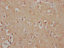 IHC image of CAC15947 diluted at 1:100 and staining in paraffin-embedded human brain tissue performed on a Leica BondTM system. After dewaxing and hydration, antigen retrieval was mediated by high pressure in a citrate buffer (pH 6.0). Section was blocked with 10% normal goat serum 30min at RT. Then primary antibody (1% BSA) was incubated at 4°C overnight. The primary is detected by a Goat anti-rabbit IgG labeled by HRP and visualized using 0.05% DAB.