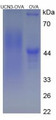 OVA Conjugated Rat Urocortin 3 (UCN3), Cat#RPU50141