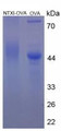 OVA Conjugated Human Cross Linked N-Telopeptide Of Type I Collagen (NTXI), Cat#RPU50808
