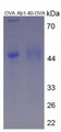 OVA Conjugated Human Amyloid Beta Peptide 1-40 (Ab1-40), Cat#RPU51084