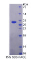 Figure 1. SDS-PAGE Figure 1. SDS-PAGE