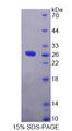 Figure 1. SDS-PAGE Figure 1. SDS-PAGE