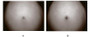 To measure the effect of IGF1 on cell proliferation, breast cancer MCF-7 cells were seeded into triplicate wells of 96-well plates at a density of 5,000 cells/well and allowed to attach, replaced with serum-free overnight, then the medium was replaced with 1% serum standard DMEM prior to the addition of various concentrations of recombinant mouse IGF1. After incubated for 96h, cells were observed by inverted microscope and cell proliferation was measured by Cell Counting Kit-8 (CCK-8). Briefly, 10µL of CCK-8 solution was added to each well of the plate, then the absorbance at 450nm was measured using a microplate reader after incubating the plate for 1-4 hours at 37℃. Proliferation of MCF-7 cells after incubation with IGF1 for 96h observed by inverted microscope was shown in Figure 2. Cell viability was assessed by CCK-8 assay after incubation with recombinant IGF1 for 96h. The result was shown in Figure 3. It was obvious that IGF1 significantly increased cell viability of MCF-7 cells.(A) MCF-7 cells cultured in DMEM, stimulated with 1ng/mL IGF1 for 96h; (B) Unstimulated MCF7 cells cultured in DMEM for 96h.Figure. Cell proliferation of MCF-7 cells after stimulated with IGF1.