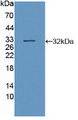 Figure . Western Blot