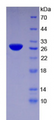 Figure . SDS-PAGE
