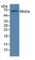 Figure . Western Blot