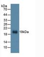 Figure . Western Blot