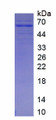 Figure. SDS-PAGE