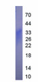 Figure. SDS-PAGE