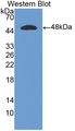 Figure . Western Blot; Sample: Recombinant Human, IFNa; Antibody: Rabbit Anti-IFNa Human Ab (PAA033Hu)