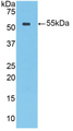 Figure . Western Blot