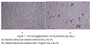 Galectin-4(GAL4) is a protein that in humans is encoded by the LGALS4 gene. The galectins are a family of beta-galactoside-binding proteins implicated in modulating cell-cell and cell-matrix interactions. LGALS4 is an S-type lectin that is strongly underexpressed in colorectal cancer. In this case, we chose rabbit erythrocyte (RaE) to assay its ability of agglutination. A general procedure for hemagglutination assay (or haemagglutination assay; HA) is as follows, two-fold dilute the recombinant pig GAL4 with 0.9% sodium chloride injection, add 50μL a serial dilution of GAL4 to each well of a U or V-bottom shaped 96-well microtiter plate. The final well serves as a negative control without GAL4, replace with 50μL 0.9% sodium chloride injection. Then add 50μL 1% rabbit erythrocyte to each well and mixed gently. The plate is incubated for 3 hours at room temperature. The results are shown. It was obvious that the minimal effective concentration of GAL4 is 7.5 μg/mL.