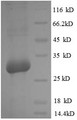 (Tris-Glycine gel) Discontinuous SDS-PAGE (reduced) with 5% enrichment gel and 15% separation gel.