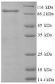 (Tris-Glycine gel) Discontinuous SDS-PAGE (reduced) with 5% enrichment gel and 15% separation gel.