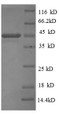 (Tris-Glycine gel) Discontinuous SDS-PAGE (reduced) with 5% enrichment gel and 15% separation gel.