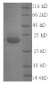(Tris-Glycine gel) Discontinuous SDS-PAGE (reduced) with 5% enrichment gel and 15% separation gel.