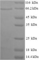 (Tris-Glycine gel) Discontinuous SDS-PAGE (reduced) with 5% enrichment gel and 15% separation gel.
