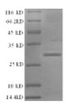
(Tris-Glycine gel) Discontinuous SDS-PAGE (reduced) with 5% enrichment gel and 15% separation gel.