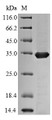 (Tris-Glycine gel) Discontinuous SDS-PAGE (reduced) with 5% enrichment gel and 15% separation gel.