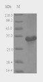 (Tris-Glycine gel) Discontinuous SDS-PAGE (reduced) with 5% enrichment gel and 15% separation gel.