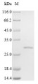 (Tris-Glycine gel) Discontinuous SDS-PAGE (reduced) with 5% enrichment gel and 15% separation gel.