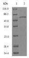 
(Tris-Glycine gel) Discontinuous SDS-PAGE (reduced) with 5% enrichment gel and 15% separation gel.