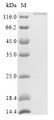 (Tris-Glycine gel) Discontinuous SDS-PAGE (reduced) with 5% enrichment gel and 15% separation gel.
