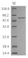 (Tris-Glycine gel) Discontinuous SDS-PAGE (reduced) with 5% enrichment gel and 15% separation gel.