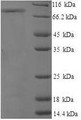 (Tris-Glycine gel) Discontinuous SDS-PAGE (reduced) with 5% enrichment gel and 15% separation gel.