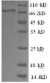 (Tris-Glycine gel) Discontinuous SDS-PAGE (reduced) with 5% enrichment gel and 15% separation gel.