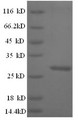 (Tris-Glycine gel) Discontinuous SDS-PAGE (reduced) with 5% enrichment gel and 15% separation gel.