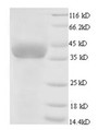 (Tris-Glycine gel) Discontinuous SDS-PAGE (reduced) with 5% enrichment gel and 15% separation gel.