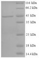 
(Tris-Glycine gel) Discontinuous SDS-PAGE (reduced) with 5% enrichment gel and 15% separation gel.