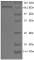 
(Tris-Glycine gel) Discontinuous SDS-PAGE (reduced) with 5% enrichment gel and 15% separation gel.