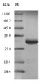 (Tris-Glycine gel) Discontinuous SDS-PAGE (reduced) with 5% enrichment gel and 15% separation gel.