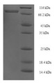 (Tris-Glycine gel) Discontinuous SDS-PAGE (reduced) with 5% enrichment gel and 15% separation gel.