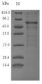 Discontinuous SDS-PAGE (reduced) with 5% enrichment gel and 15% separation gel.