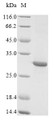 (Tris-Glycine gel) Discontinuous SDS-PAGE (reduced) with 5% enrichment gel and 15% separation gel.
