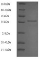 (Tris-Glycine gel) Discontinuous SDS-PAGE (reduced) with 5% enrichment gel and 15% separation gel.