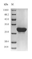 (Tris-Glycine gel) Discontinuous SDS-PAGE (reduced) with 5% enrichment gel and 15% separation gel.