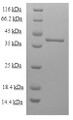 (Tris-Glycine gel) Discontinuous SDS-PAGE (reduced) with 5% enrichment gel and 15% separation gel.