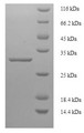 (Tris-Glycine gel) Discontinuous SDS-PAGE (reduced) with 5% enrichment gel and 15% separation gel.